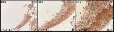 Immunohistochemical Expression of the Alpha Nicotinic Acetylcholine Receptor 7 in the Human Normal, Diabetic, and Preeclamptic Placenta and Products of Conception